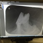 The Xray of Jasper's tooth